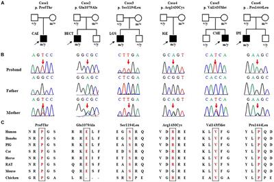 SHROOM4 Variants Are Associated With X-Linked Epilepsy With Features of Generalized Seizures or Generalized Discharges